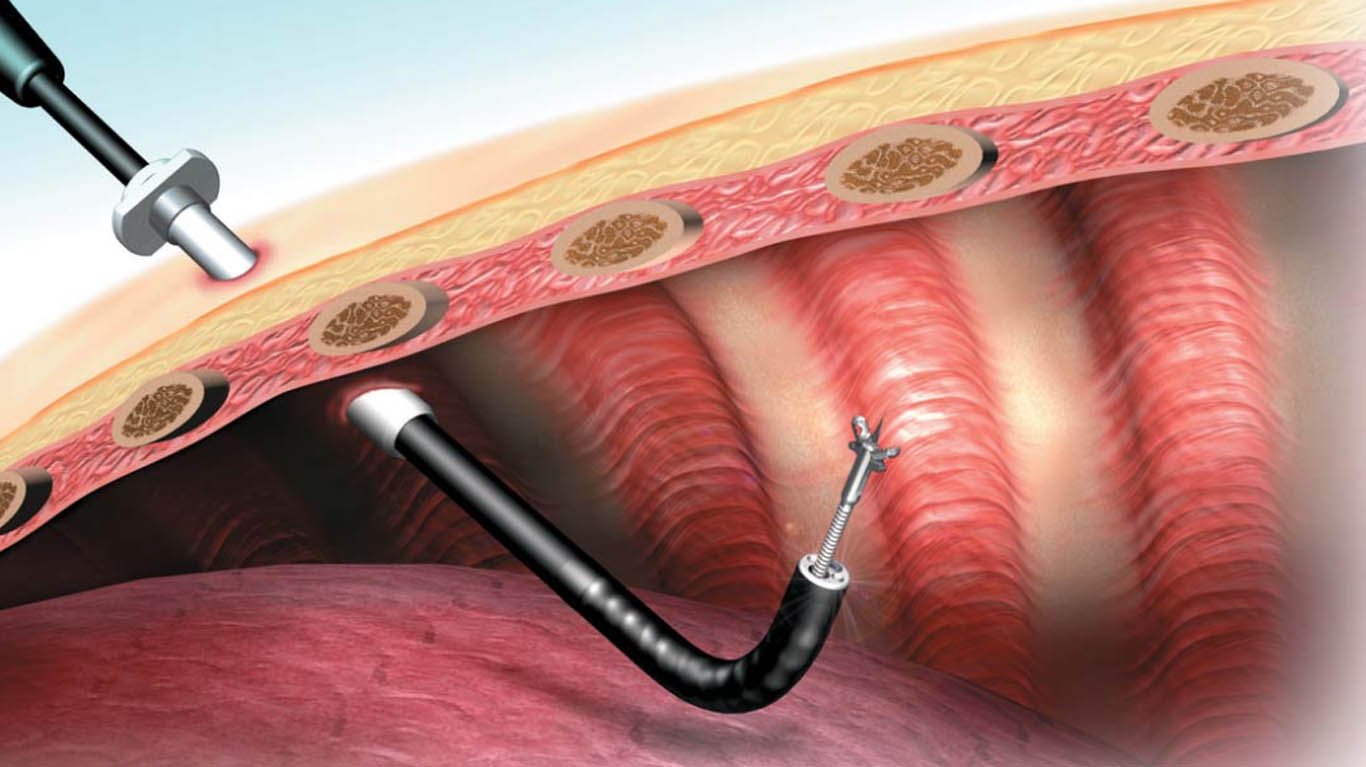 Best Doctor for Wheezing in Teynampet