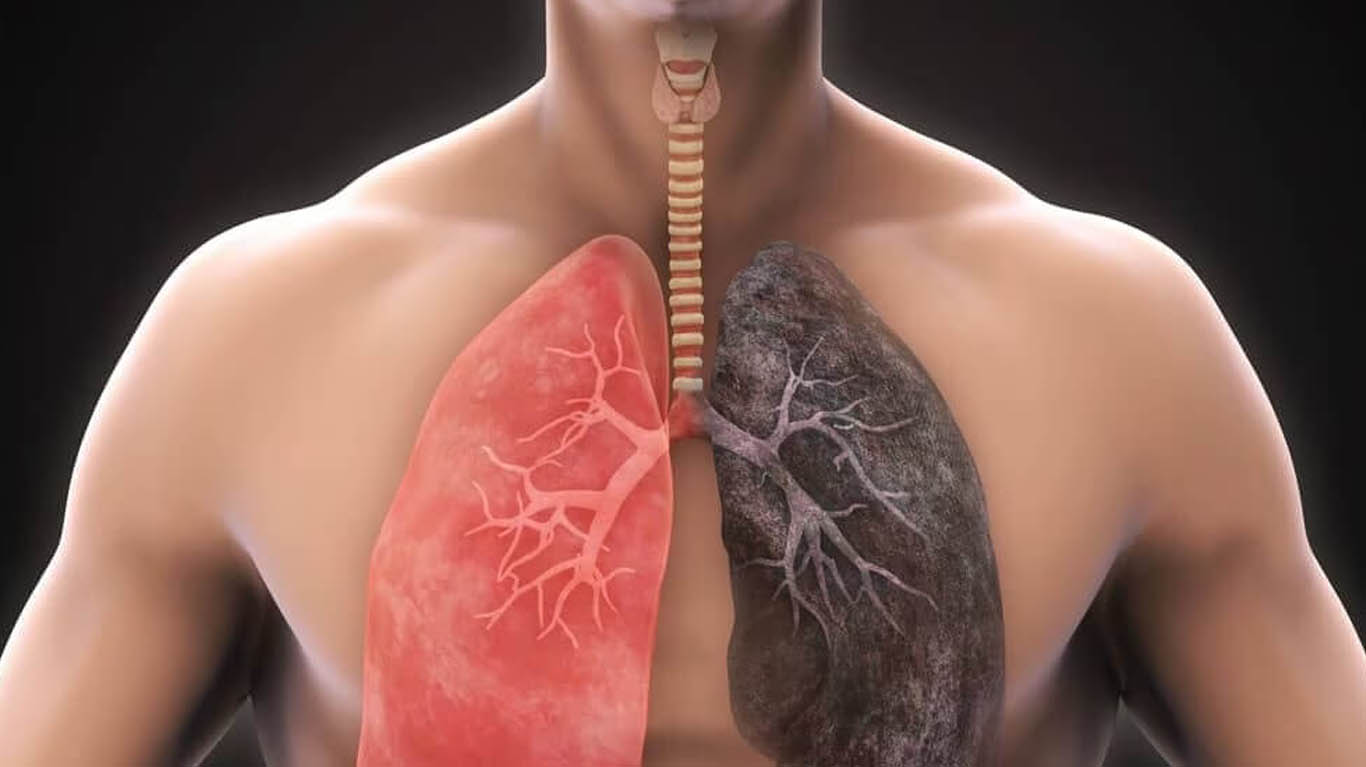 Best Doctor for ILD in Teynampet