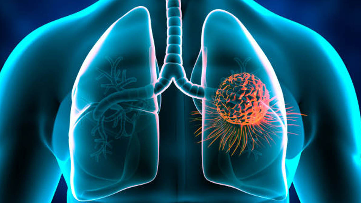 Best Asthma Specialist in Teynampet